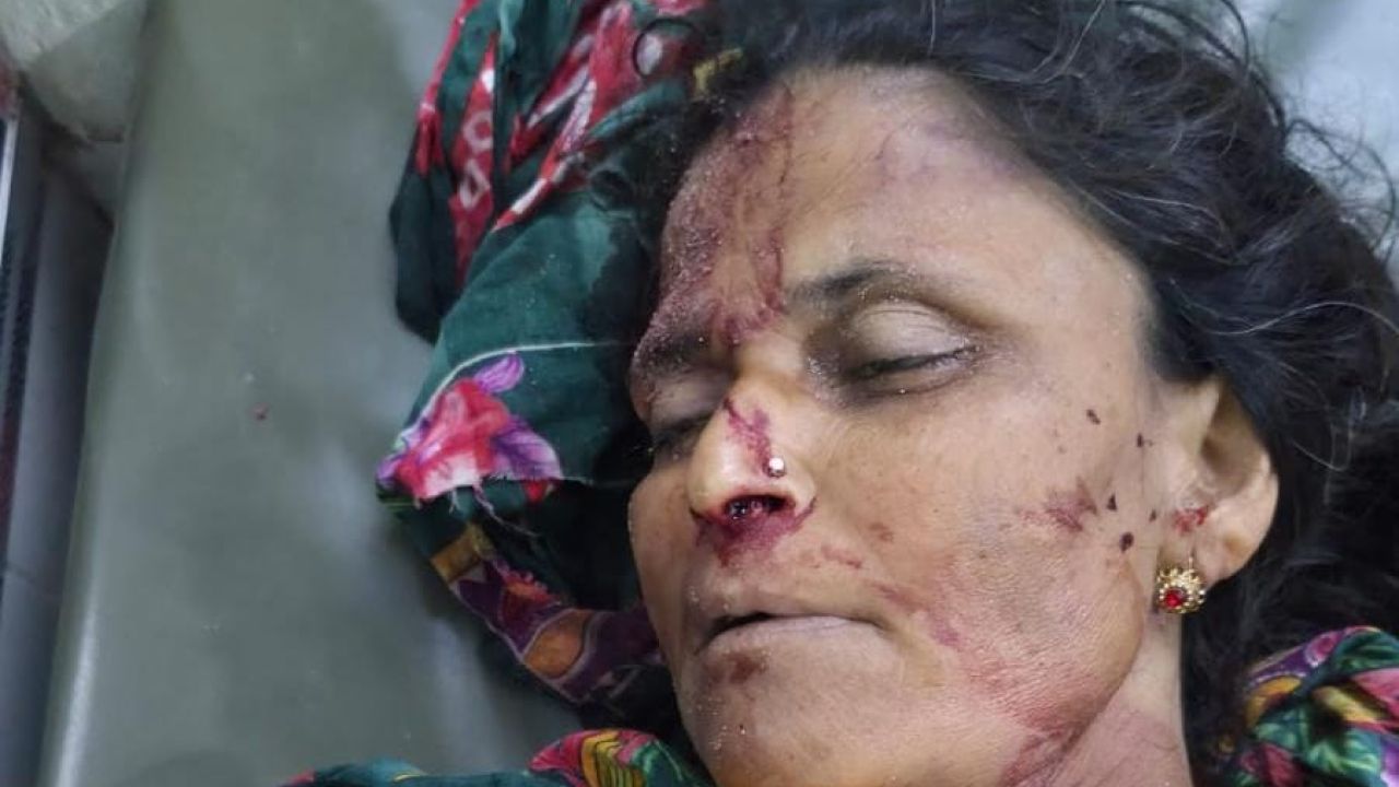সাভারে নির্মাণাধীন ভবনের লিফটের ফাঁকা জায়গা থেকে পড়ে নারী শ্রমিকের রহস্যজনক মৃত্যু।