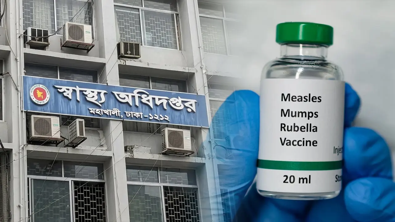 হামের উপসর্গে আরও পাঁচজনের মৃত্যু, আক্রান্ত বেড়ে ১১৮০